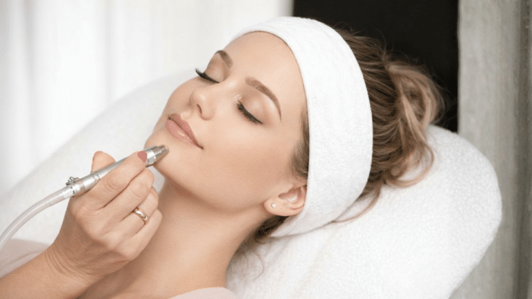 Kvinde får diamantslibning af huden hos WP Cosmetic